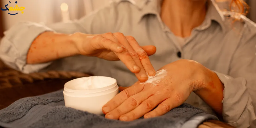 فواید استفاده از کرم شب