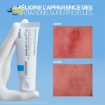 کرم ترمیم‌کننده لاروش پوزای Cicaplast Baume B5+ حجم 40 میلی‌لیتر - Image 3